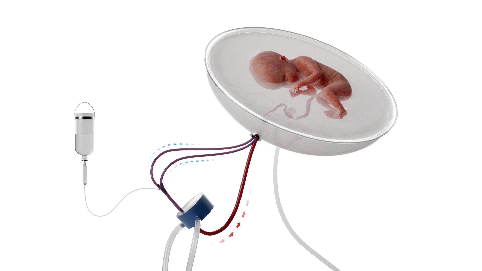 Recreació de com podria ser la futura aplicació clínica del projecte en humans
